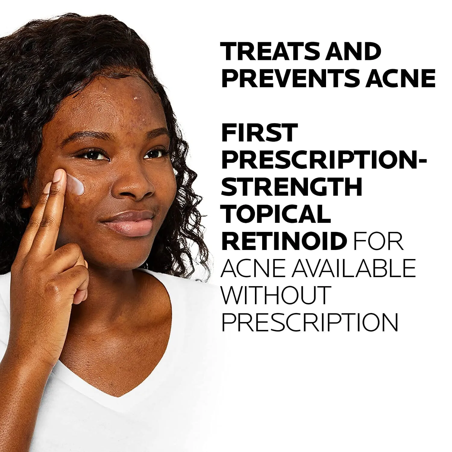La Roche-Posay Effaclar Adapalene Gel 0.1% Topical Retinoid for Acne